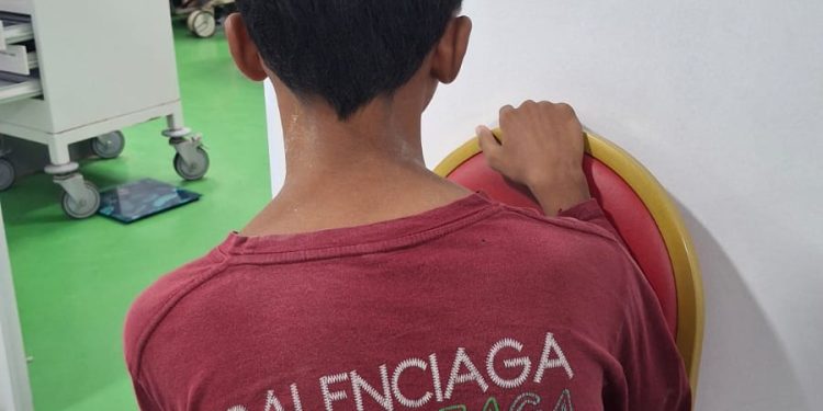 Remaja SMP di Pagedangan Udik Diduga Dianiaya Pria 29 Tahun, Keluarga Minta Keadilan
