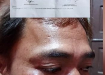 Kipri Herdiansya Biro Koran Pontensi Sekaligus Bendahara DPD IWO I Kota Pagar Alam Korban Penganiayaan Kontraktor Lokal “RL”